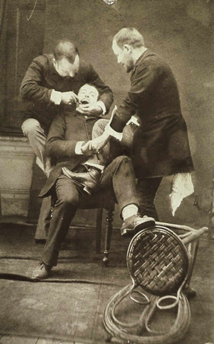 Виривання зуба. Фото початку ХХ ст.