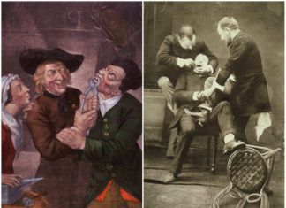 Як 100 років тому у Львові лікували зуби