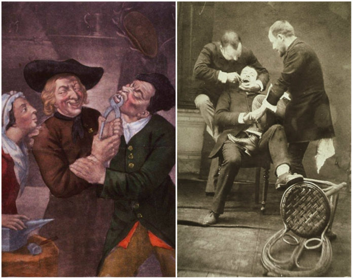 Як 100 років тому у Львові лікували зуби