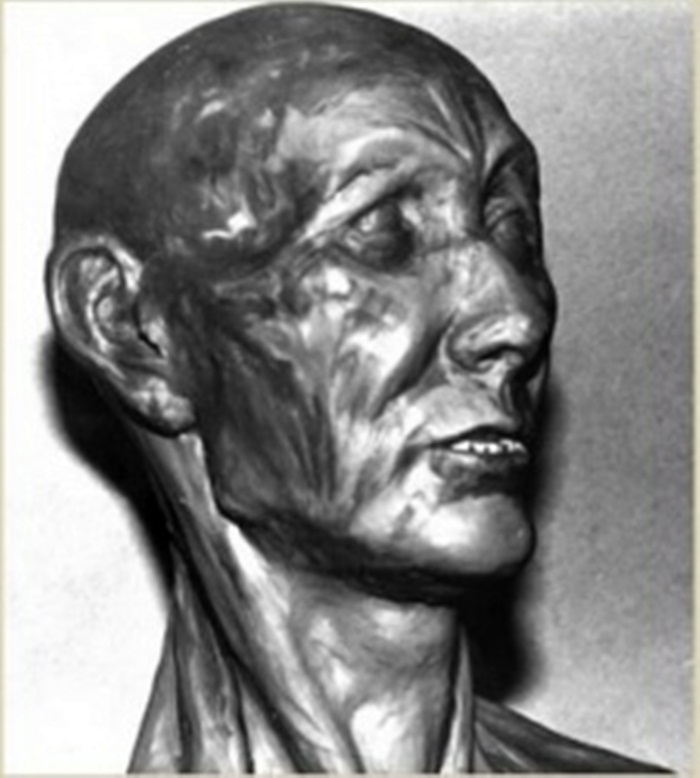 Реконструкція зовнішності умовного "князя Ярослава Осмомисла" (професор Зенон Погорецький, травень 1992 року)