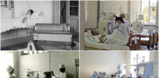 Техніка, яка рятує життя або коротка історія гемодіалізу у світі, Україні та Львові