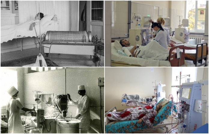 Техніка, яка рятує життя або коротка історія гемодіалізу у світі, Україні та Львові