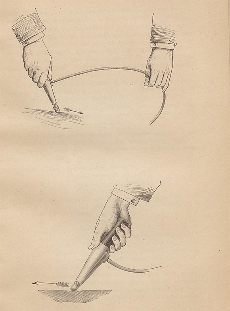 Ілюстрація з книжки «Leczenie ruchowe i mięsienie» («Моторотерапія і масаж») – посібник із мистецтва тогочасного масажу з використанням механічних вібраторів.